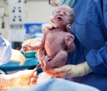 caesarean section in detail