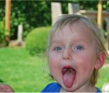 Hand, foot and mouth disease - Signs and symptoms