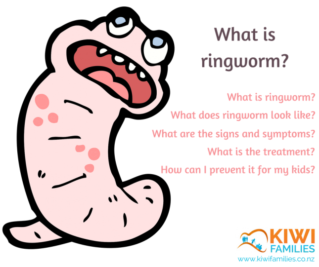 What is ringworm