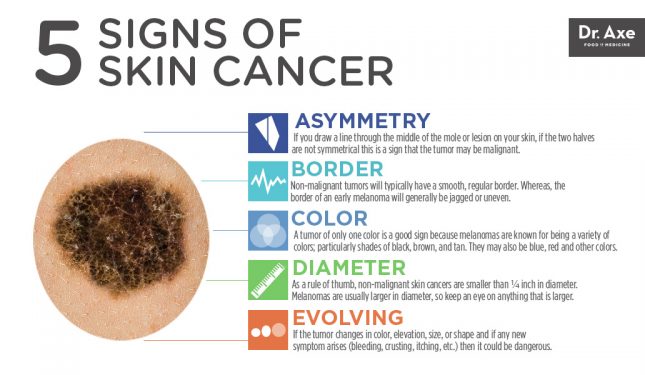 What does skin cancer look like