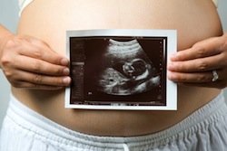 Natural fertility: What is the Sympto Thermal Method? fertility