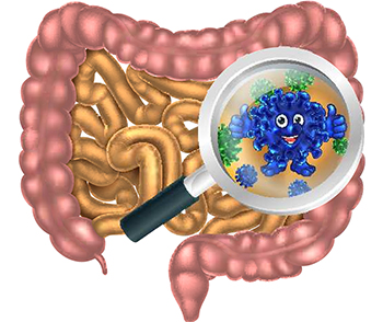 gut inflammation and probiotics