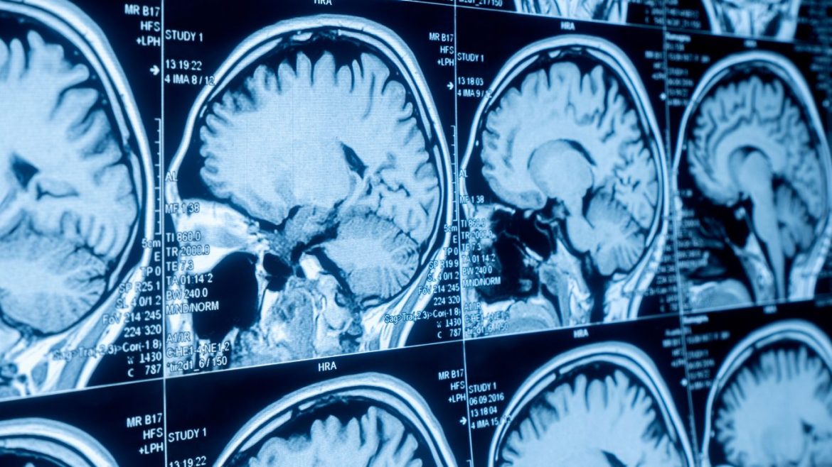 Top 10 Foods That Are Flooding Your Brain with Microplastics